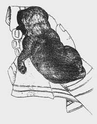 early_neurological_stimulation_en_img_4s